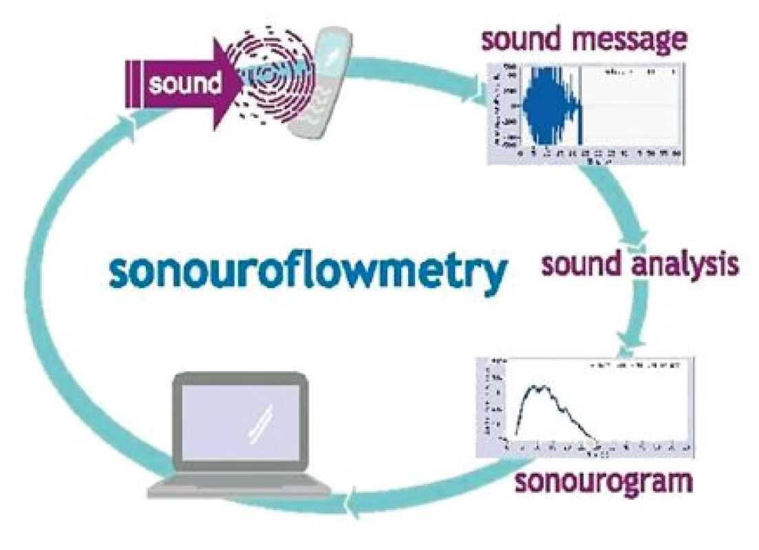 Schematické znázornění přenosu a zpracování zvuku