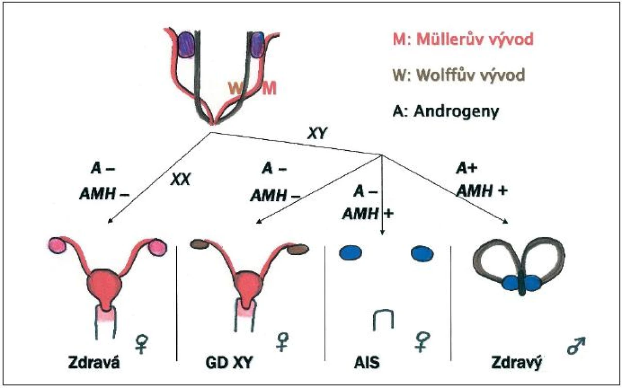 Nahoře: Müllerovy a Wolffovy pohlavní vývody a indiferentní gonády v embryonálním období
