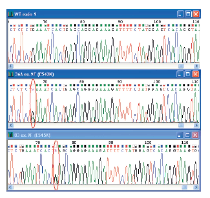 Elektroferogramy zobrazujúce wild-type sekvenciu a dve „hotspot“ mutácie vyskytujúce sa v exóne 9 PIK3CA génu. Na obrázku sú uvedené čísla vzoriek a typ mutácie. Miesto mutácie je vyznačené.
