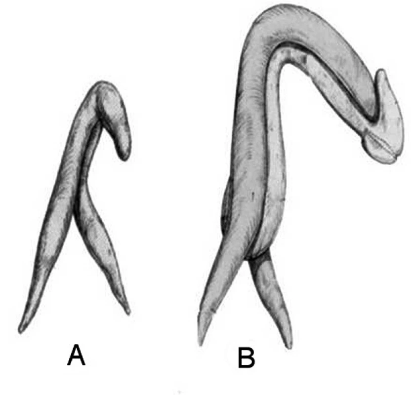 Srovnání kavernózních struktur klitorisu a penisu. A. Klitoris. B. Penis. Obrázek je publikován s laskavým svolením Vincenza Puppa.
