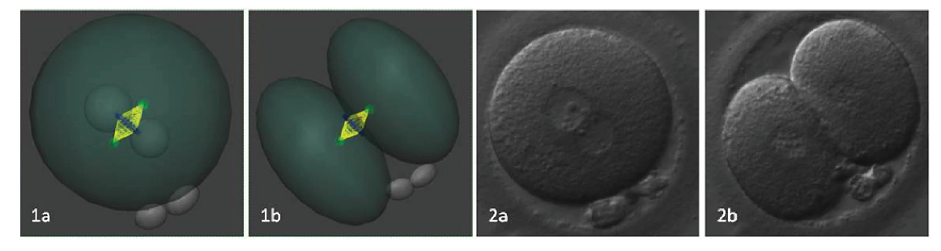 Rovnomernosť distribúcie polarizovanej ooplazmy je ovplyvnená rovinou delenia, ktorá je daná polohou prvojadier pred nástupom syngamie.
1a/b. 3D rekonštrukcia polohy deliaceho vretienka v závislosti od polohy prvojadier. 2a/b. embryo v reálnom zobrazení pred a po ukončení prvého bunkového cyklu. Autor obrázkov a 3D modelov D. Hlinka