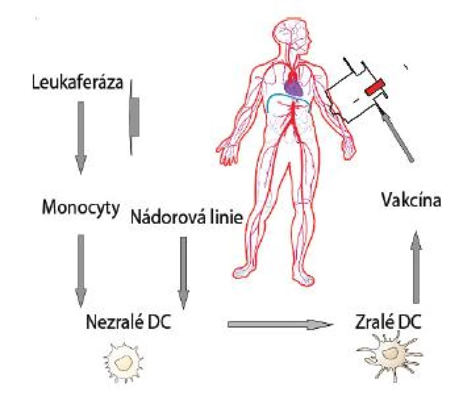 Obecné schéma imunoterapie dendritickými buňkami je znázorněno na obrázku
