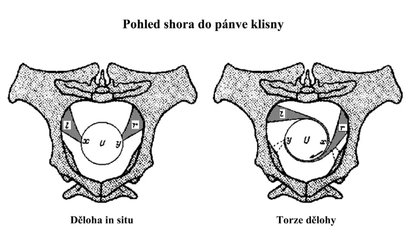 Schéma ukotvení dělohy v pánvi klisny a torze dělohy