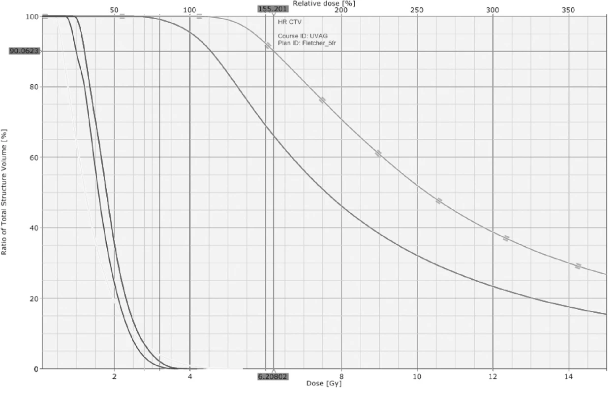 Rozložení dávky ve formě DVH (dose-volume histogramu) při 3D brachyterapii
