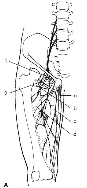 N. obturatorius
Místa úžin a kompresí: 1 a 2 při průchodu foramen obturatorium.
Svaly: a – m. gracilis, b – m. adductor minimus, c – m. adductor longus, d – m. adductor brevis.