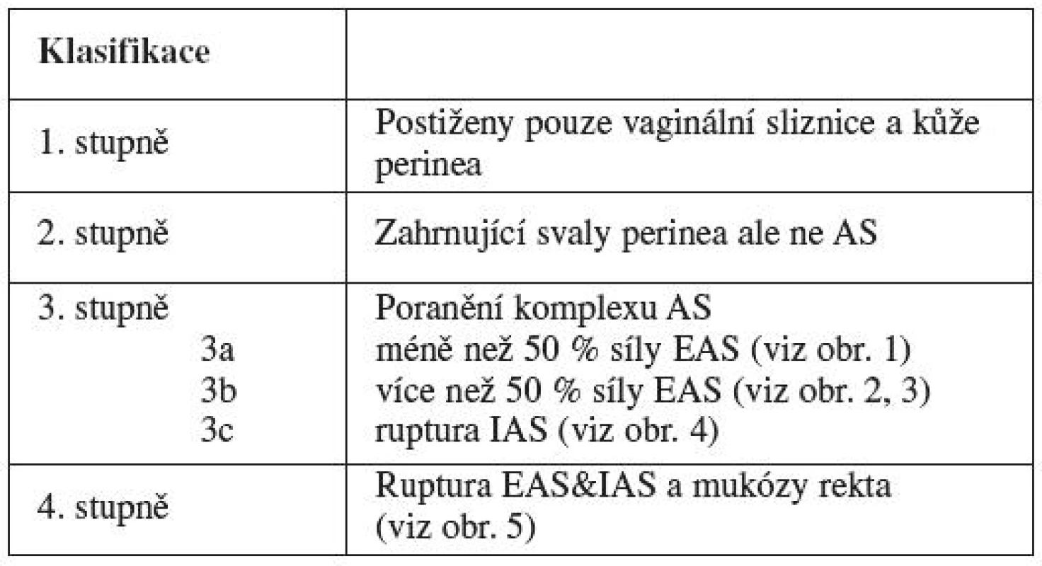 Klasifikace ruptur perinea podle RCOG Guideline No 29 [2]