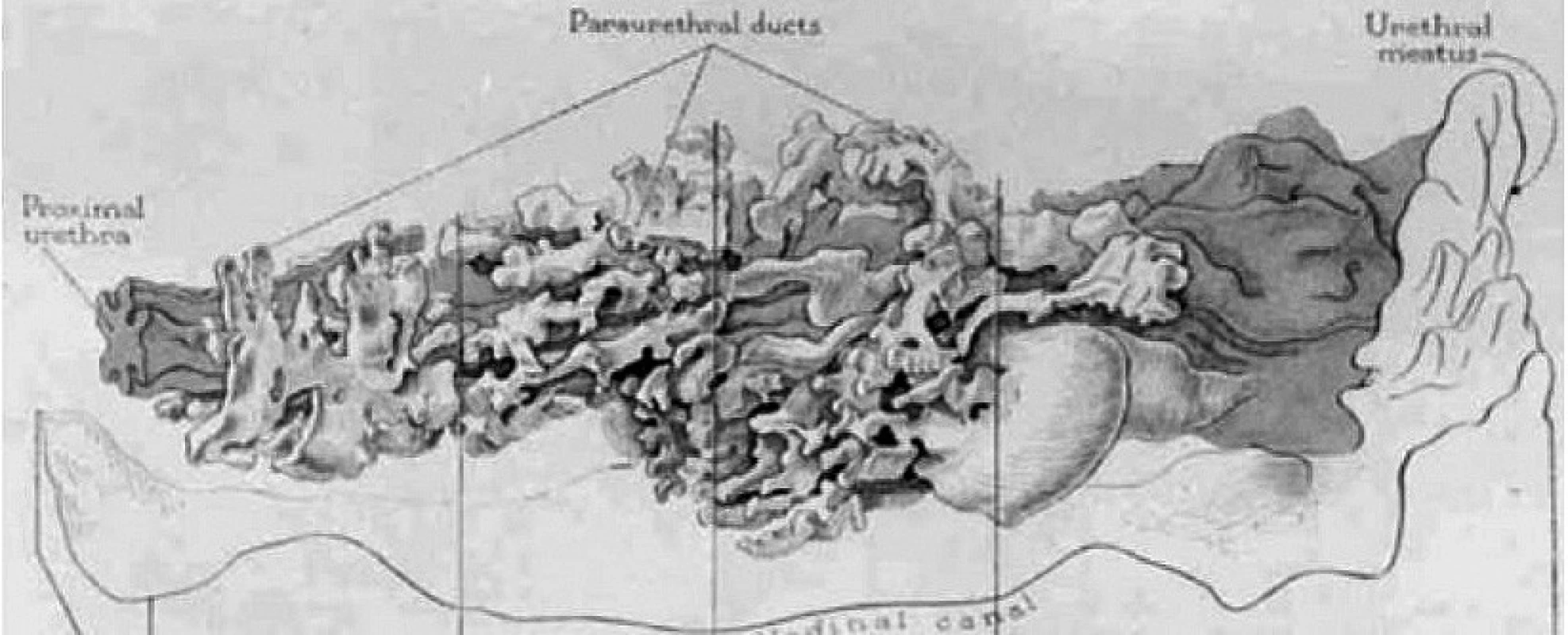 Huffmanův voskový model ženské prostaty, longitudinální pohled (zdroj: Huffman, J. The detailed anatomy of the paraurethral ducts in the adult human female. Am J Obstet Gynecol, 1948, 55, p. 86–101)