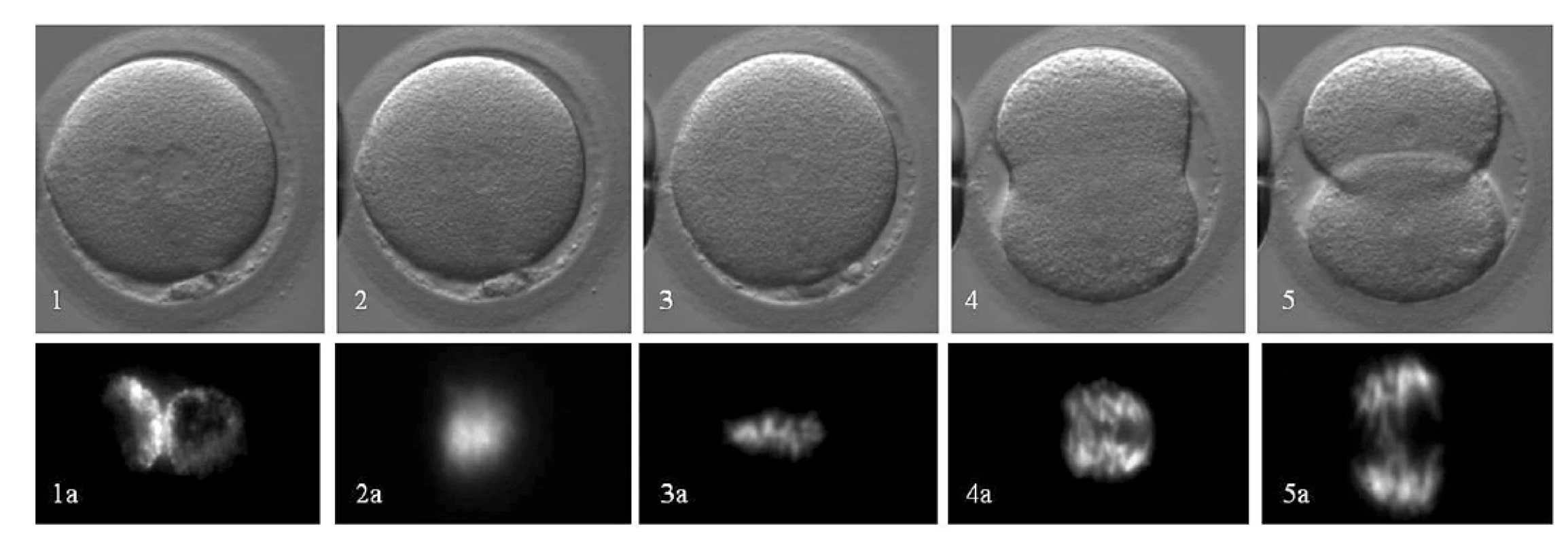 Priebeh 1. mitotického delenia embryí: Hoffman Modulation Contrast (1–5) a intravitálne farbenia chromatínu farbivom Hoechst 33342
(1a–5a). Časový priebeh: Prometafáza (1–2): vymiznutie prvojadier (tj. koniec prvej interfázy), zmiešanie maternálnych a paternálnych chromozómov a začiatok tvorby deliaceho vretienka: 20–30 min. Metafáza (3): usporiadanie kondenzovaných chromozómov v equatoriálnej rovine a plné vyvinutie bipolárneho deliaceho vretienka: 120–140 min. Anafáza (4), Telofáza (5): segregácia chromozómov do dcérskych buniek: 20–30min. Následne obe bunky vstupujú do druhej interfázy. Autor obrázkov D. Hlinka