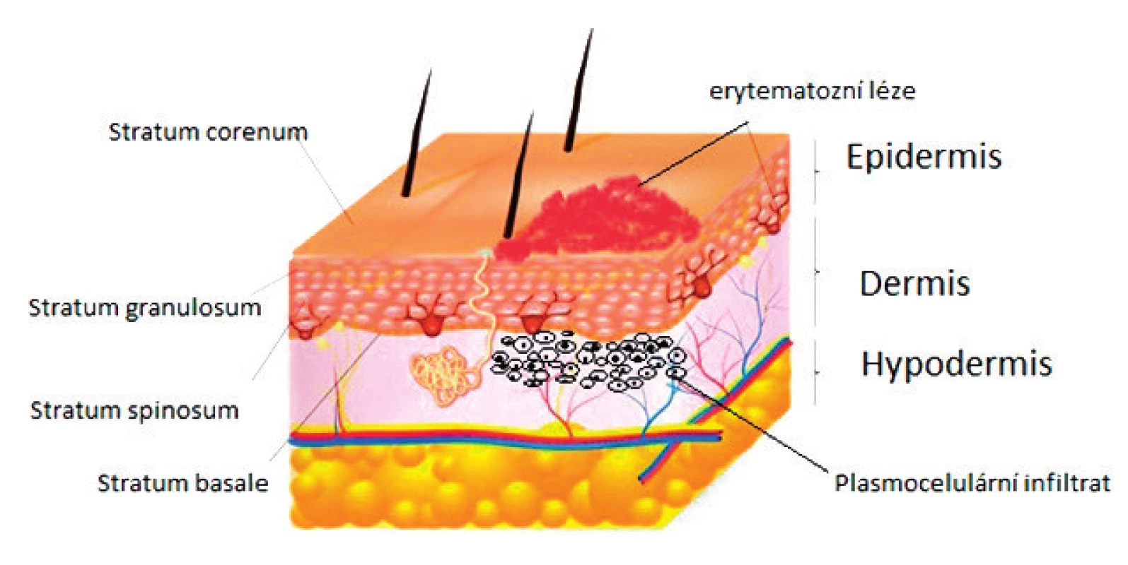 Schéma mikroskopické struktury epidermis