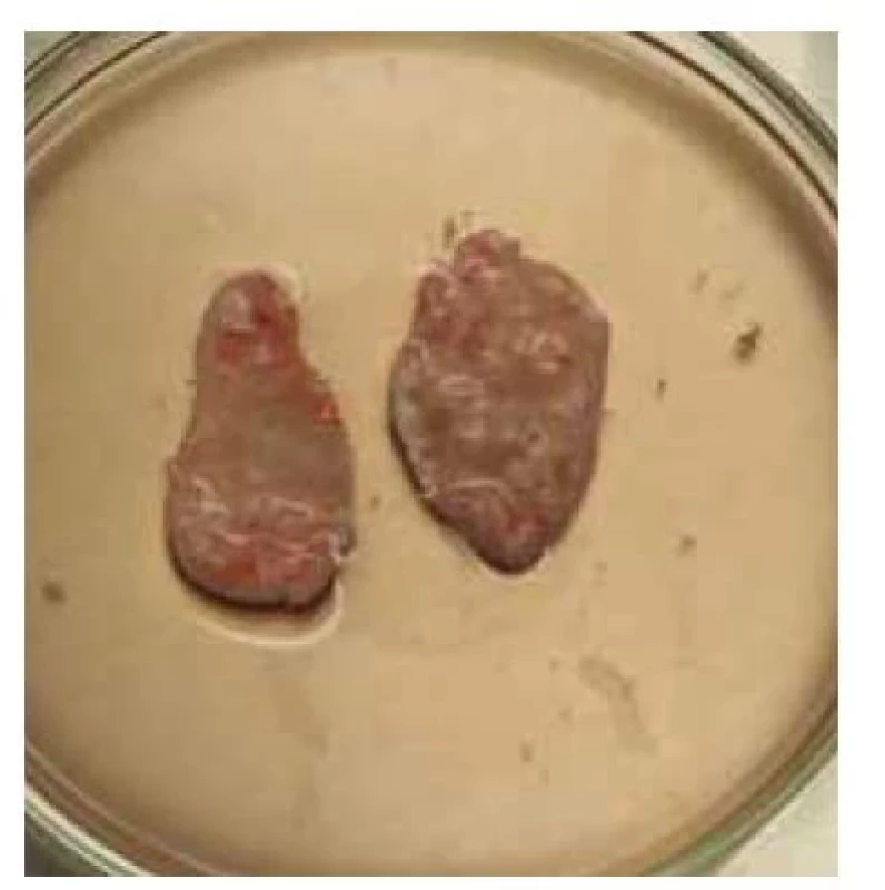 Kortikální tkáň po odstranění
meduly.<br>
Fig. 6. Cortical tissue after removal of
the medulla.