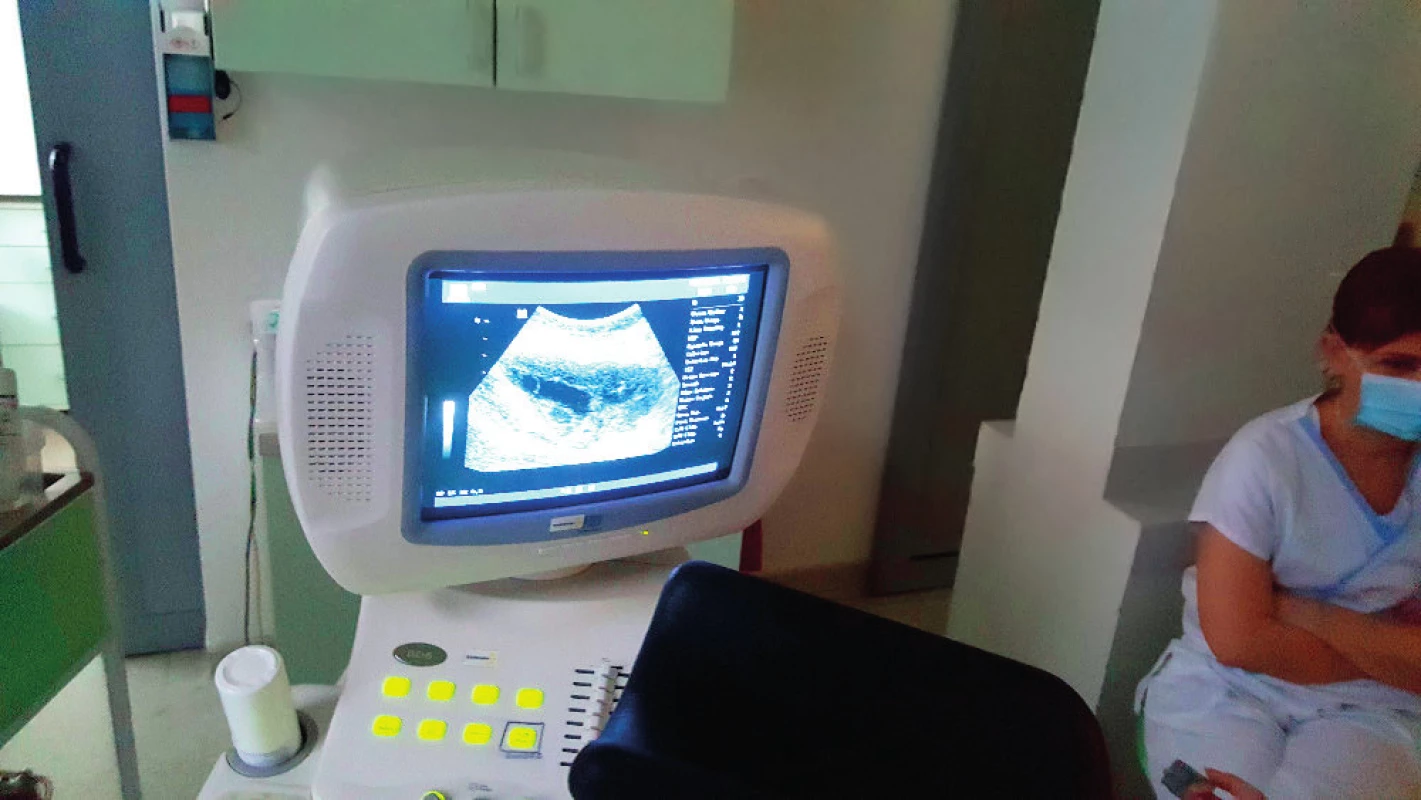 Ultrazvukové zobrazeni stimulovaného ovaria abdominálni sondou