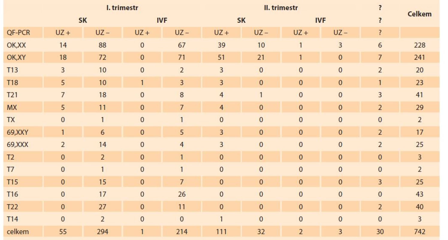Přehled výsledků vyšetření potracených plodů metodou QF-PCR.<br>
Tab. 2. Overview of the results of the examination of aborted fetuses by QF-PCR.