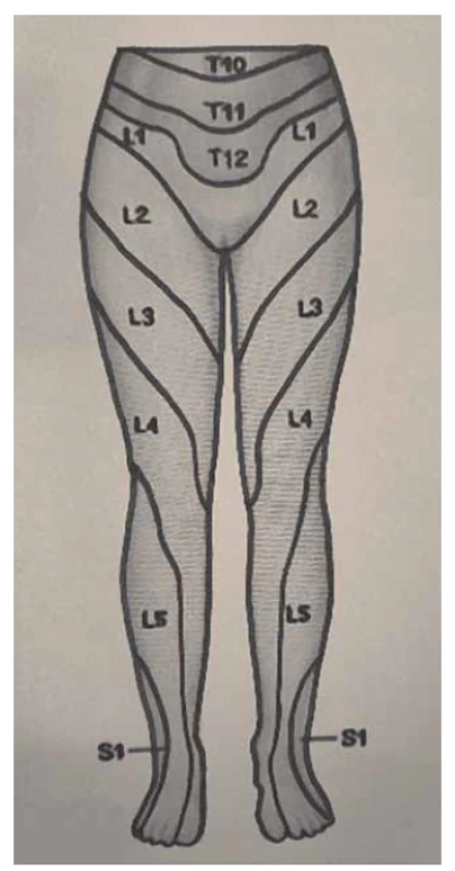 Dermatomy dolních končetin,
pohled zepředu.<br>
Fig. 1. Dermatomes of the lower limbs,
front view.