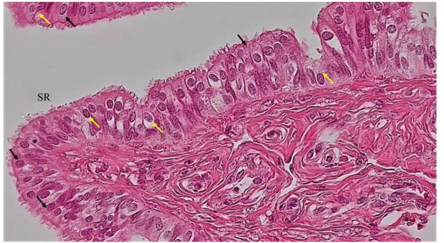 Detail slizničnej riasy (SR) ampully vajíčkovodu. Jednovrstvový cylindrický epitel je tvorený dvoma hlavnými populáciami
buniek – cylindrickými bunkami s pohyblivými riasinkami (čierne šípky) a sekrečnými bunkami.<br>
Fig. 8. Detail of the mucosal alga (SR) of the ampulla of the fallopian tube. The single-layered columnar epithelium is formed
by two main populations of cells – columnar cells with motile cilia (black arrows) and secretory cells.